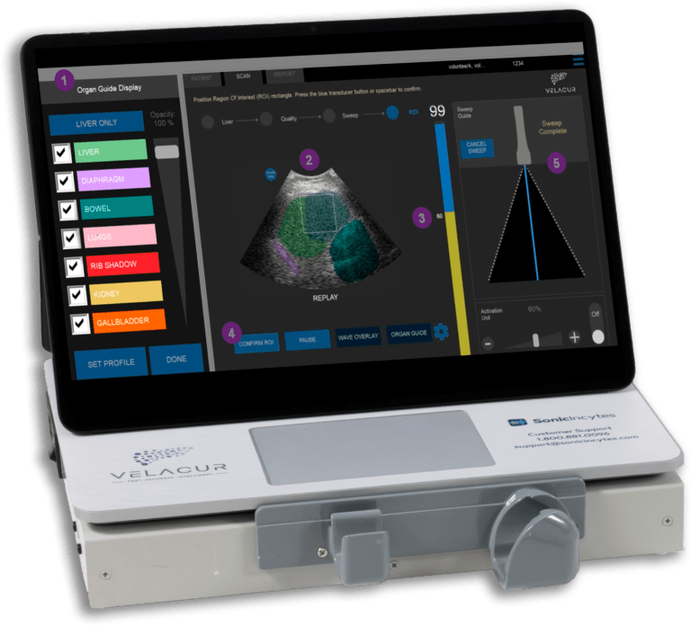 Velacur Organ Guide on b-mode image